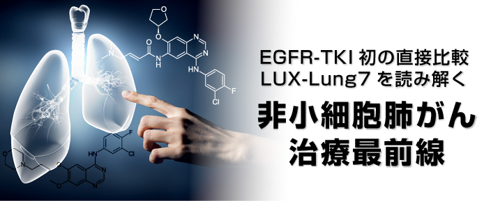 非小細胞肺がん治療最前線－EGFR-TKI初の直接比較、LUX-Lung7を読み解く