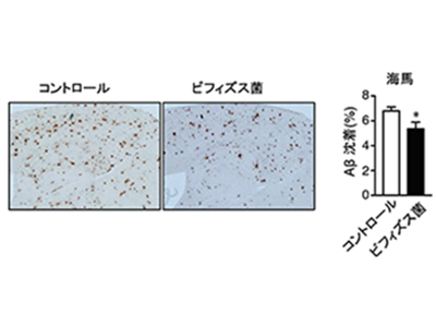ビフィズス菌MCC1274のアルツハイマー予防効果をマウスで確認－名古屋市立大ほか
