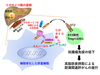 NASH肝がん、肝臓に移行の腸内細菌叢成分で促進される仕組みを解明－大阪公立大ほか