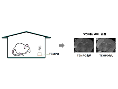 脳梗塞などの「脳保護療法」として、TEMPOの吸入投与が有効な可能性－群大ほか