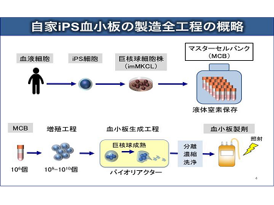 再生不良性貧血に対するiPS細胞由来血小板の自己輸血、1年経過で「問題なし」－京大ほか
