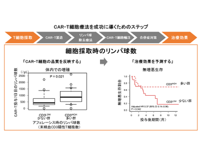CAR-T細胞療法、アフェレーシス時末梢血リンパ球数が治療効果と相関－京大