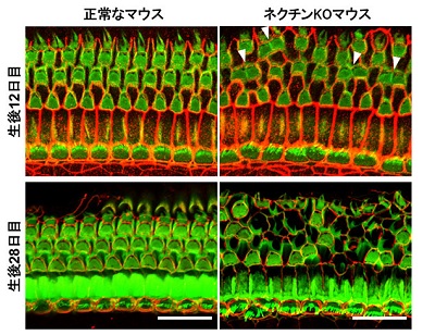 聴覚機能には、内耳コルチ器でみられる市松模様の細胞パターンが必須－神戸大ほか