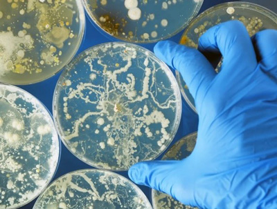 キャンディン系抗真菌薬耐性のカンジダ・アウリス感染症が米国で急増、CDCが警鐘