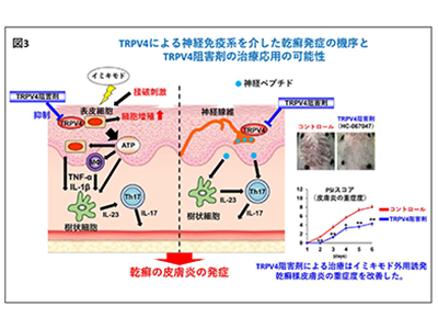 乾癬の病態に重要な分子を発見、温度感受性受容体チャネルTRPV4－群大ほか