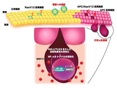 大腸がん等の浸潤、がん排除機構「細胞融合」が逆に利用されると判明－東京理科大