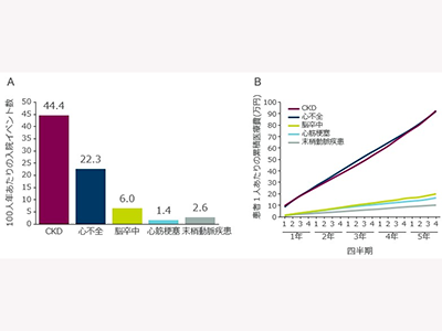 未治療CKDの深刻なリスクを明らかに、日本含むリアルワールドデータより－香川大