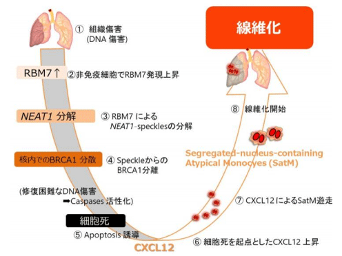 有効な治療薬のない「線維症」の発症に伴いRBM7発現上昇、創薬