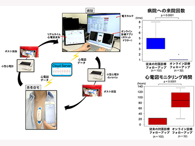 心臓不整脈、心電図モニタリング可能な遠隔診療の安全性と有用性を確認－神戸大ほか