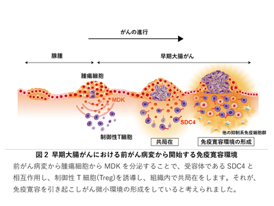 早期大腸がん、発がん予測につながる免疫寛容の仕組みを同定－九大ほか