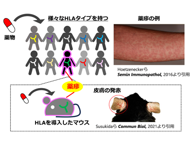 薬疹の発生、HLAを介したケラチノサイトでの小胞体ストレスが原因と判明－千葉大