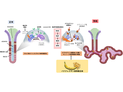 新規胃がん発生メカニズム解明、バナナ成分を含む治療薬開発の可能性－東大病院ほか