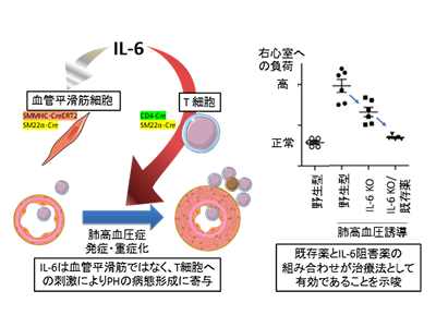 肺高血圧症の発症・進展に、ヘルパーT細胞のIL-6シグナルが関与－国循