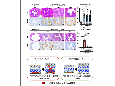 食道扁平上皮がんで高頻度のNRF2変異、がん化促進の仕組みを解明－東北大ほか