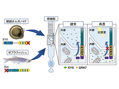 EYS関連網膜色素変性に視細胞変性への光暴露が関与、ヒトiPS細胞で解明－理研ほか