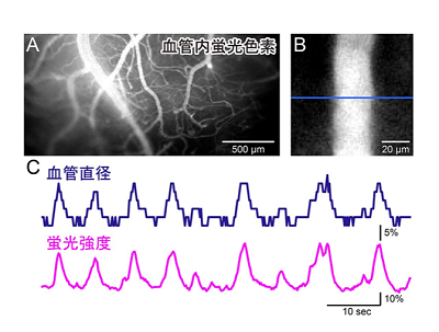 視覚刺激による脳内血管トレーニング、脳機能拡張につながる可能性－東北大