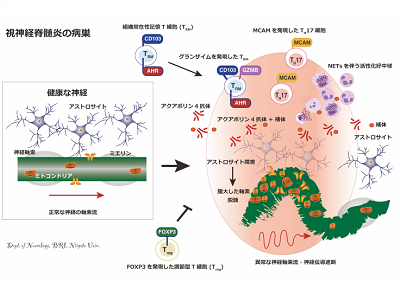 視神経脊髄炎、炎症を正負に制御する新たな免疫の仕組みを解明－新潟大ほか