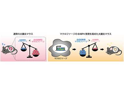 IBD新規治療につながる時計遺伝子同定、炎症抑制型マクロファージ増加に関与－山口大