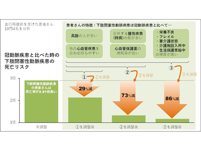 血行再建術後の死亡率、下肢閉塞性動脈疾患は冠動脈疾患の約3倍－阪大ほか