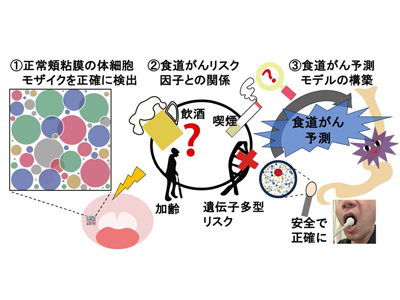 食道がんリスク、非侵襲的な頬粘膜検査で予測－京大ほか