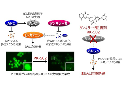 切除不能進行・再発大腸がん対象、タンキラーゼ阻害剤の医師主導治験開始－がん研ほか
