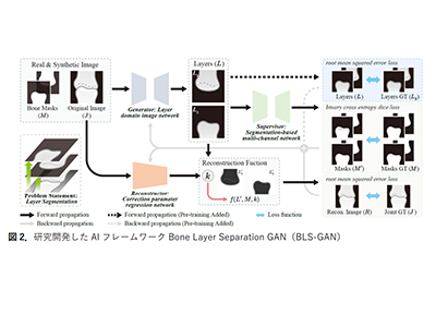 関節リウマチ、AIを活用した新技術「BLS-GAN」で診断精度向上－北大ほか