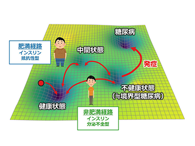 糖尿病、数理解析で肥満の有無による発症経路の違いを解明－富山大