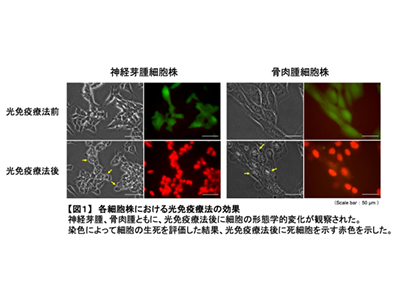 神経芽腫・骨肉腫、光免疫療法が有用な可能性－北大