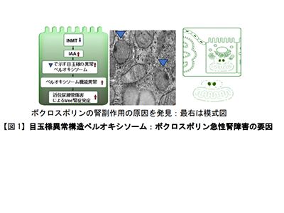 ループス腎炎、ボクロスポリンによる急性腎障害の機序を解明－徳島大
