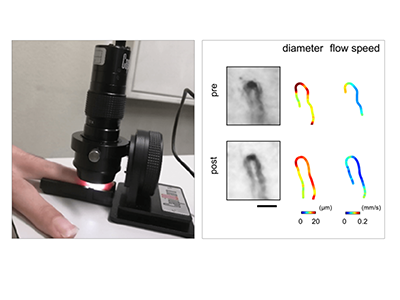 腎疾患、透析前後の血液成分変化を非侵襲で検出する方法を開発－電通大ほか
