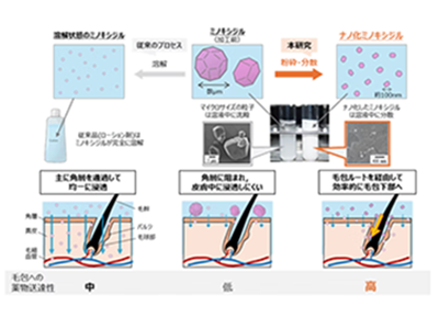 「ナノ化ミノキシジル」で発毛効果が早まる可能性、マウスで効果確認－大正製薬ほか