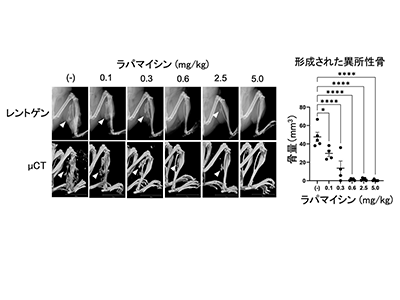 進行性骨化性線維異形成症、ラパマイシンを用いた新規治療戦略開発－CiRA