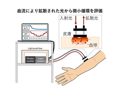 出血性ショックにおける微小循環変化の可視化に成功、光学的血流計測で－明大ほか