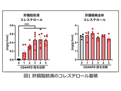 MASLD、肝脂肪滴中コレステロールとMASH発症の関連解明－千葉大ほか