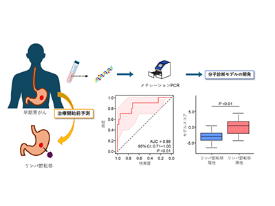 早期胃がん、リンパ節転移リスクを血液検査で予測する新技術開発－科学大