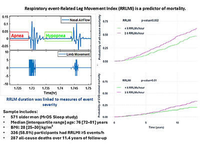 OSA患者のRRLMs頻度、重症度や死亡リスクと関連－埼玉県立大ほか
