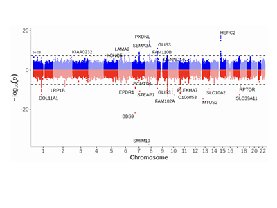 原発閉塞隅角緑内障、134のリスク遺伝子領域を新たに同定－京都府医大ほか